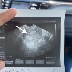Arizona Center For Reproductive Endocrinology & Infertility - First 4w4d ultrasound! He dated  & assured me we will monitor this pregnancy to make sure baby is healthy and growing!