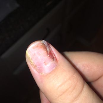 Lee Nail Salon - Came in with a full gel set, and left with bare nails and a bloody ripped thumb nail. - Nail Salons Near Me - Chicago, Illinois