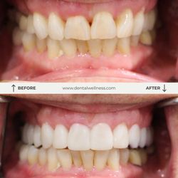 Dental Wellness