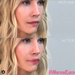 Nurse Kara - Bickman Medical Aesthetics