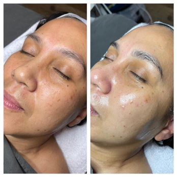 Gravitas Medspa - Before and after - Permanent Makeup Near Me - Beverly Hills, California