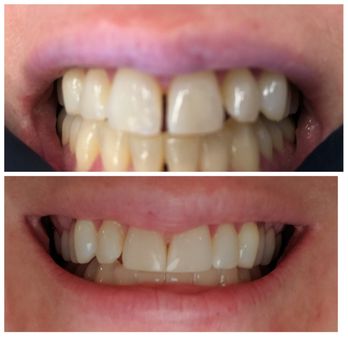 Mark W Jacob, DDS - Periodontists Near Me - Deerfield, Illinois Mark W Jacob, DDS - Periodontists Near Me - Deerfield, Illinois