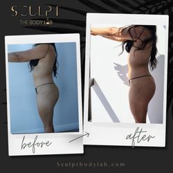 Sculpt The Body Lab - Non Invasive body sculpting