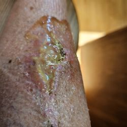 Daniel Hoffman - Skin Win Dermatology