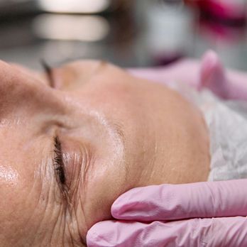 Amara Med Spa - We offer a range of facial treatments including microneedling, chemical peels, photofacials, dermaplaning, and microdermabrasions. - Skin Care Near Me - St. George, Utah