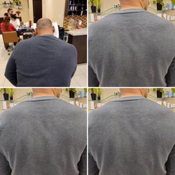 Top left is the before. As you can see the other three after pics I'm much more aligned.