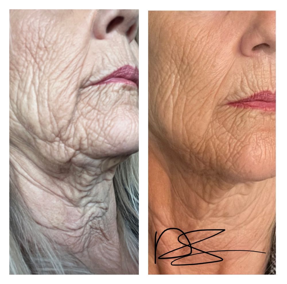 The Med Spa at Clinical Edge Logo