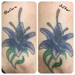 Tattoo Sugaring. Deep exfoliation of the tattooed area causing the ink to be rejuvenated.