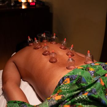 Body Sense - Cupping Therapy - Acupuncture Near Me - Coral Gables, Florida Body Sense - Cupping Therapy - Acupuncture Near Me - Coral Gables, Florida