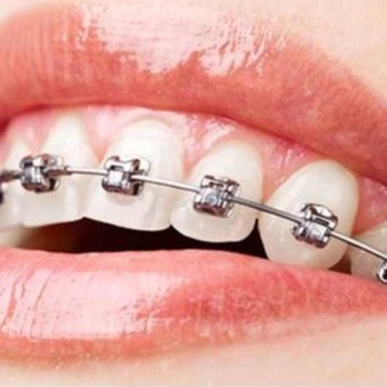 Wellcare Dentistry - General Dentistry Near Me - Bakersfield, California Wellcare Dentistry - General Dentistry Near Me - Bakersfield, California