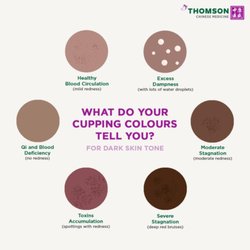 Manos de Luz Massage & Hijama - Cupping color explanation.