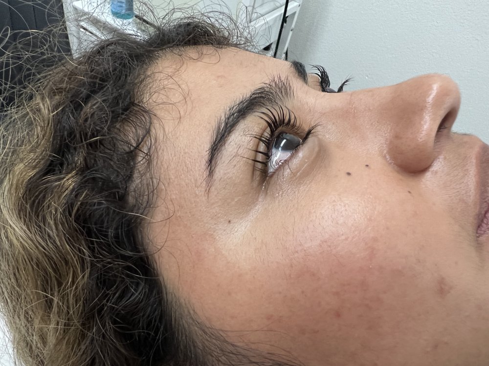 Skins Awakening  Logo