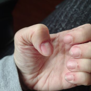 Awesome Nails - I was bleeding and hurt - Nail Salons Near Me - Washingtonville, New York Awesome Nails - I was bleeding and hurt - Nail Salons Near Me - Washingtonville, New York