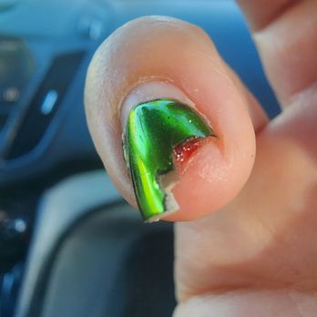 Natural Nails - After getting pulled off - Nail Salons Near Me - Thousand Oaks, California Natural Nails - After getting pulled off - Nail Salons Near Me - Thousand Oaks, California