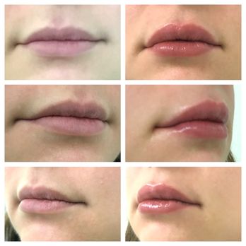 We Rejuvenate You - Cosmetic Surgeons Near Me - Greenwich, Connecticut We Rejuvenate You - Cosmetic Surgeons Near Me - Greenwich, Connecticut