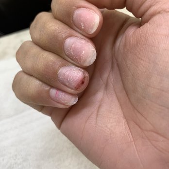 Rose Nails & Spa - My nails after taking off the acrylics and buffing. - Nail Salons Near Me - Whittier, California