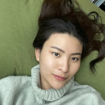 Daisy MD Care - 5 months with Daisy MD. From severe acne, to this! - Skin Care Near Me - Downey, California
