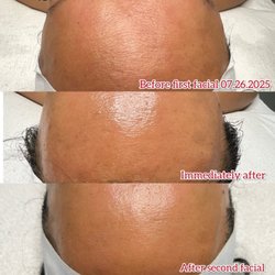 Roots Esthetics