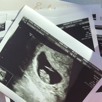 Unique Ultrasound - Diagnostic Imaging Near Me - Temecula, California Unique Ultrasound - Diagnostic Imaging Near Me - Temecula, California