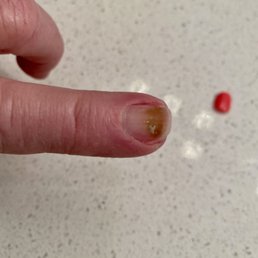 Fungus from dip powder at Nail Lounge