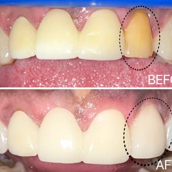 Bình Phạm BINH P PHAM, DDS - Updated August 2025 - 12 Photos & 10