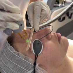 Laser Queen Beauty Studio - Laser Genesis skin rejuvenation with GentleMax Pro in Hallandale Beach. Boosts collagen & elastin, reduces wrinkles for radiant skin