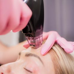 Glow Medical Aesthetics - Morpheus8 laser at Glow! Treat fine lines and wrinkles, pore size, and improve collagen and jawline contouring