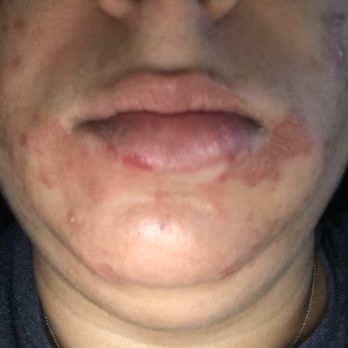 WOW Brows! - This was about 2 hours after my wax. - Hair Removal Near Me - Charlotte, North Carolina