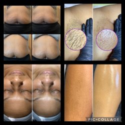 Body Contouring, Brazilian Wax, Facial and Leg Wax