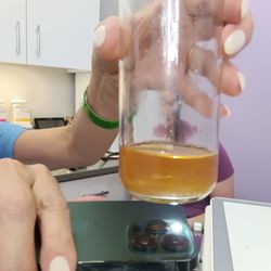 Luxura Modern Aesthetix - Extractions emptied into this jar.