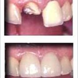 Mohr & Mohr Smiles Dentistry