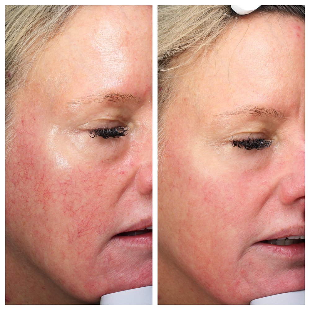 VEGA VITALITY BACK BAY Updated October 2024 64 Photos & 96 Reviews