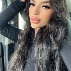 Finesse Med Spa And Iv Lounge - Beautiful skin & freshly filled lips