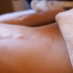 Living Well Chinese Medicine - Acupuncture - Dr. Golding practices a gentle Japanese form of Acupuncture to deal with the Root problem.