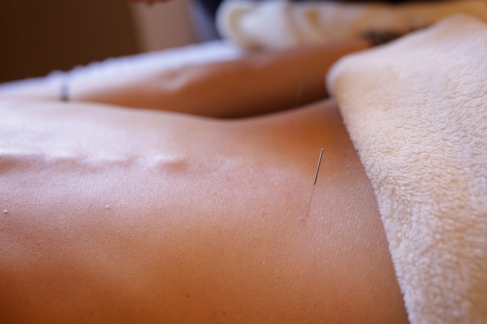 Living Well Chinese Medicine - Acupuncture Logo