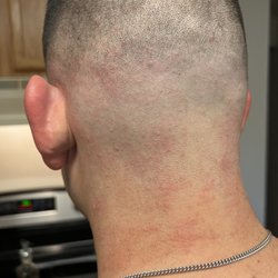 Haircuts By Sunni - After hair cut had burns and bumps