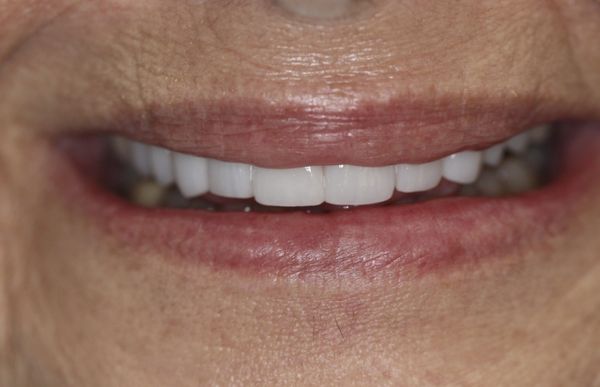 Parkhaven Dental Care