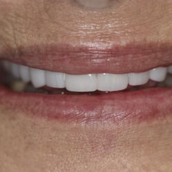 Parkhaven Dental Care - Before and After photos