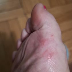 Posh Nail 1  - My right foot on Monday.