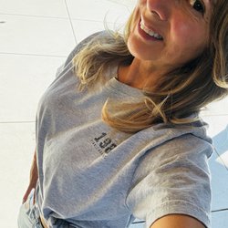 Medspa Deluxe LA - One month before CO2 laser.