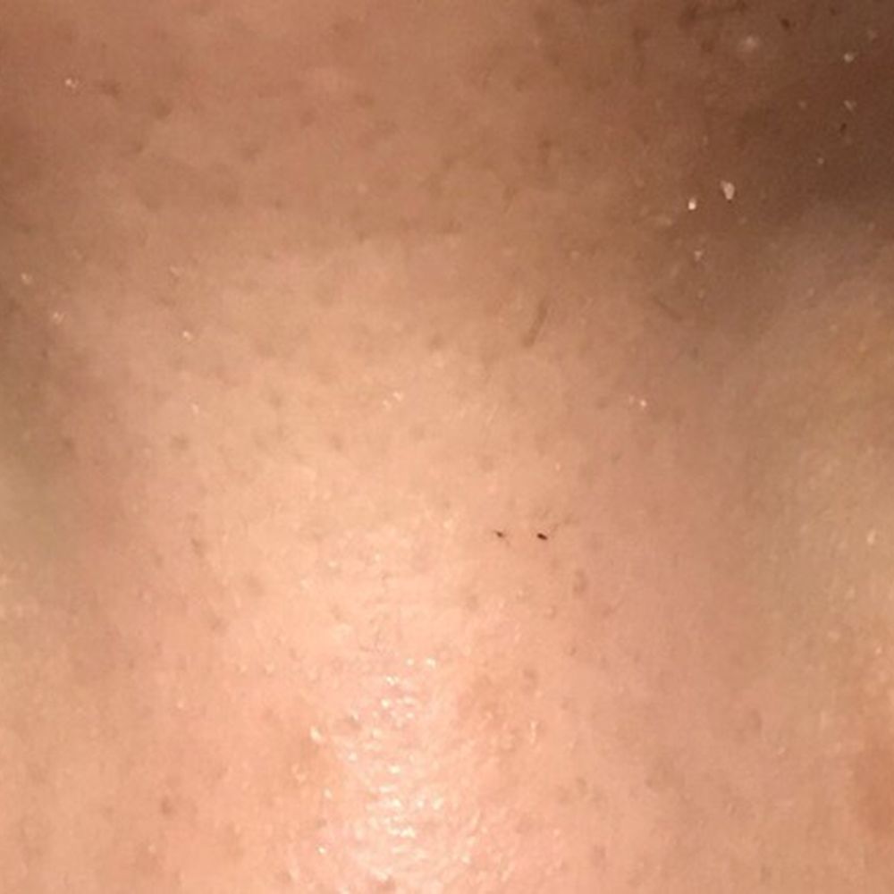 Miel K-Beauty spa - Romantic with volume - Skin Care Near Me - Arlington Heights, Illinois Miel K-Beauty spa - Romantic with volume - Skin Care Near Me - Arlington Heights, Illinois