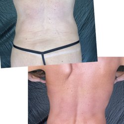 Hawaii Glow n' Go - Before and after. Go as light or as dark as you want. Smooth even flawless coverage!