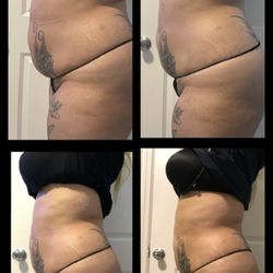 BodySculpt305