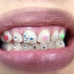 Black Adder Beauty Bar - Tooth gems