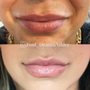 Photo of Pout Medspa