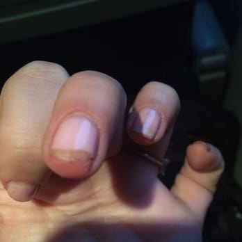 Acqua Nails - Ouch my weak nails are now ripping - Nail Salons Near Me - Bethesda, Maryland Acqua Nails - Ouch my weak nails are now ripping - Nail Salons Near Me - Bethesda, Maryland