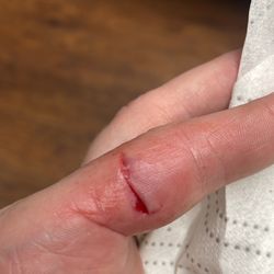 Accelerated Urgent Care