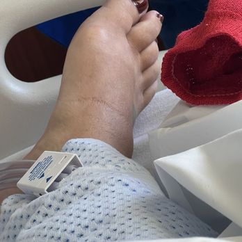 Christopher Grayson MD - Once fixed you will see the huge difference. Dr Grayson and his wonderful colleagues literally saved my life! - Sports Medicine Near Me - Palm Harbor, Florida