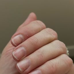 My ruined nails My ruined nails