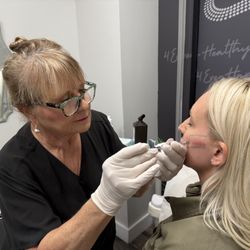 4Ever Young Med Spa & Wellness Center - Boca Raton - Juvederm Cheek Fillers 4Ever Young Med Spa Boca Raton